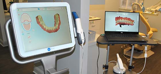 Intraoral scanner Marietta GA