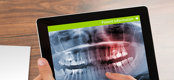 digital dental X-rays Marietta GA
